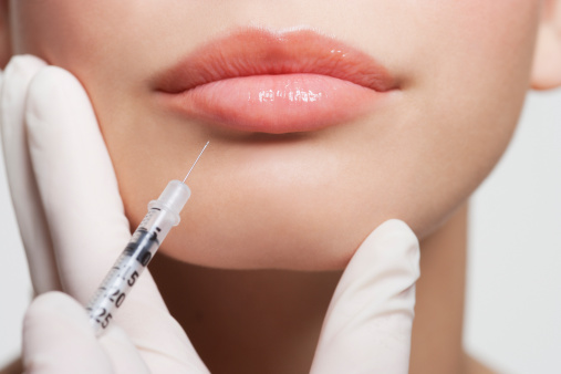 Juvederm Treatment