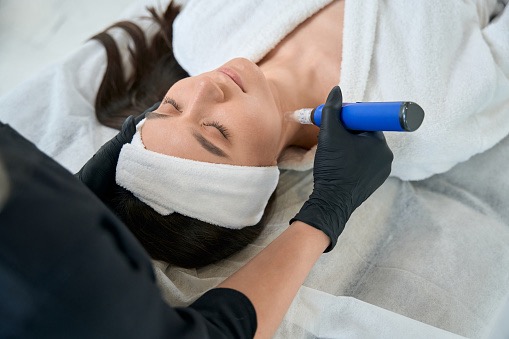 SkinPen Microneedling Services